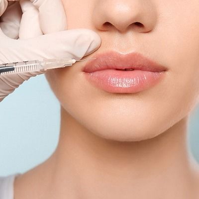 What Makes Russian Lip Fillers Look Unique?